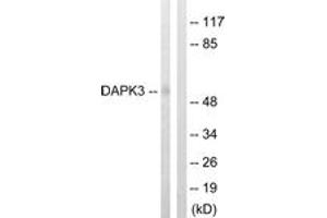 Western blot analysis of extracts from HuvEc cells, using DAPK3 (Ab-265) Antibody. (DAPK3 抗体  (AA 241-290))