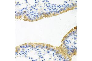 Immunohistochemistry of paraffin-embedded mouse lung using TOB2 antibody. (TOB2 抗体)
