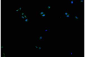 Immunofluorescence (IF) image for anti-Cytochrome P450, Family 2, Subfamily A, Polypeptide 13 (CYP2A13) (AA 252-354) antibody (ABIN7149223)