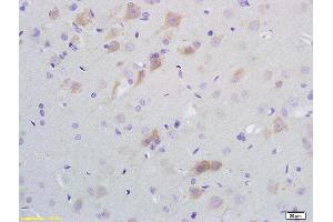 Formalin-fixed and paraffin embedded rat brain tissue labeled with Anti-SCD1 Polyclonal Antibody, Unconjugated (ABIN704111) at 1:200 followed by conjugation to the secondary antibody and DAB staining (SCD 抗体  (AA 265-359))