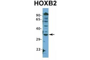 Host:  Rabbit  Target Name:  HOXB2  Sample Type:  HepG2  Antibody Dilution:  1. (HOXB2 抗体  (N-Term))