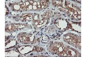 Immunohistochemical staining of paraffin-embedded Human Kidney tissue using anti-AKT1 mouse monoclonal antibody. (AKT1 抗体)