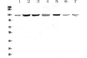 Western blot analysis of SMC6L1 using anti-SMC6L1 antibody . (SMC6 抗体  (AA 205-443))