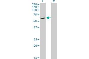 Western Blot analysis of FPGT expression in transfected 293T cell line by FPGT MaxPab polyclonal antibody. (FPGT 抗体  (AA 1-594))