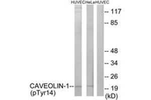 Western blot analysis of extracts from HuvEc cells treated with PMA 125ng/ml 30' and HeLa cells treated with LPS 100ng/ml 30', using Caveolin-1 (Phospho-Tyr14) Antibody.