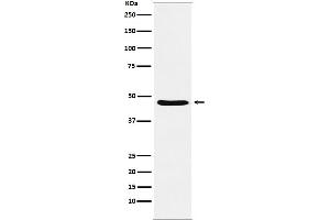 Western blot analysis of Dopamine Receptor D3 expression in SH-SY5Y cell lysate.