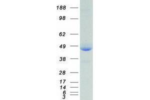 XRCC4 Protein (Transcript Variant 3) (Myc-DYKDDDDK Tag)