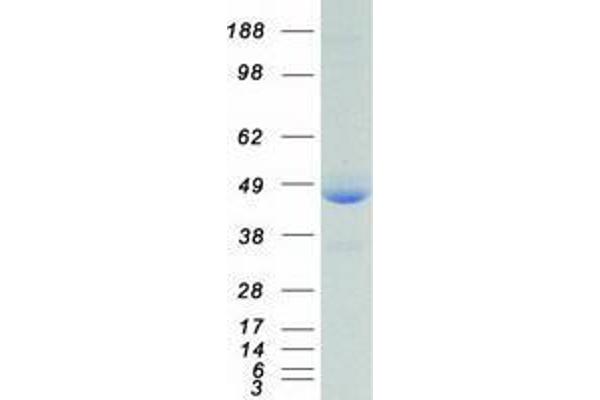 XRCC4 Protein (Transcript Variant 3) (Myc-DYKDDDDK Tag)