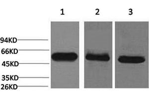Western Blotting (WB) image for anti-Caspase 8 (CASP8) antibody (ABIN5960798) (Caspase 8 抗体)