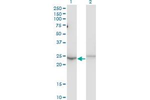 Western Blot analysis of MBD5 expression in transfected 293T cell line by MBD5 monoclonal antibody (M01), clone 4A12-1B6. (MBD5 抗体  (AA 1-229))