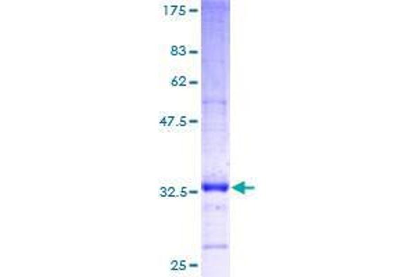 EML4 Protein (AA 1-62) (GST tag)