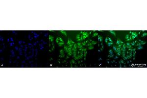 Immunocytochemistry/Immunofluorescence analysis using Mouse Anti-Ubiquitin Monoclonal Antibody, Clone 5B9-B3 . (Ubiquitin 抗体  (HRP))