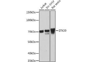 Western blot analysis of extracts of various cell lines, using STK39 Rabbit mAb (ABIN1682890, ABIN3015922, ABIN3015923 and ABIN7101461) at 1:1000 dilution. (STK39 抗体)