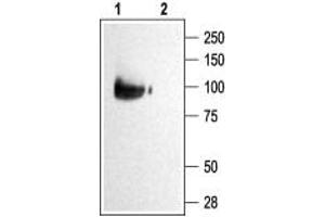 Western blot analysis of KCNQ2 transfected HEK-293 cells: - 1. (KCNQ2 抗体  (C-Term, Intracellular))
