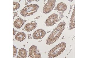 IHC analysis of VDAC3 using anti-VDAC3 antibody (ABIN7602541).