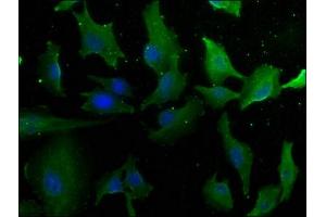 Immunofluorescence staining of U251 cells with ABIN7157870 at 1:50, counter-stained with DAPI. (LAMa4 抗体  (AA 1593-1823))