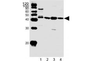 Western blot analysis of lysate from 1) HepG2 cell line and human 2) heart, 3) skeletal muscle, 4) kidney tissue using SPHK1 antibody at 1:1000. (SPHK1 抗体  (AA 59-89))