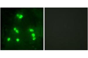 Immunofluorescence analysis of A549 cells, using HAIR Antibody. (Hairless 抗体  (AA 41-90))
