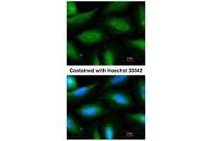 ICC/IF Image Immunofluorescence analysis of methanol-fixed HeLa, using FBXL2, antibody at 1:200 dilution. (FBXL2 抗体  (N-Term))