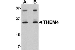 Western blot analysis of THEM4 in human liver tissue lysate with this product at (A) 1 and (B) 2 μg/ml.