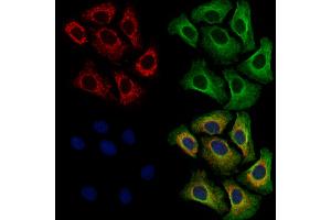 ABIN7094690 and ABIN7098741 staining Hela cells by IF/ICC.
