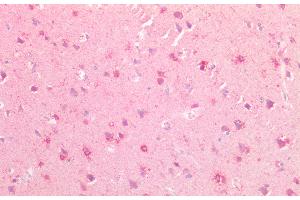 Immunohistochemistry (IHC) image for anti-Slit Homolog 3 (SLIT3) (AA 1405-1512) antibody (ABIN7435490)