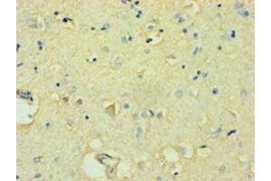 Immunohistochemistry of paraffin-embedded human brain tissue using ABIN7152490 at dilution of 1:100 (FBXW11 抗体  (AA 1-140))