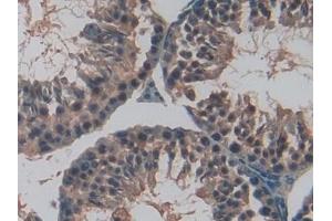 Detection of TFR2 in Mouse Testis Tissue using Polyclonal Antibody to Transferrin Receptor 2 (TFR2) (Transferrin Receptor 2 抗体  (AA 86-259))