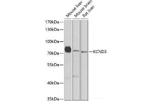 Western blot analysis of extracts of various cell lines using KCND3 Polyclonal Antibody at dilution of 1:1000. (KCND3 抗体)