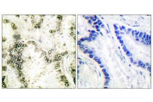 Immunohistochemistry (IHC) image for anti-X-Ray Repair Complementing Defective Repair in Chinese Hamster Cells 6 (XRCC6) (C-Term) antibody (ABIN1848653) (XRCC6 抗体  (C-Term))