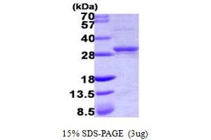 SDS-PAGE (SDS) image for Cytidine Monophosphate (UMP-CMP) Kinase 1, Cytosolic (CMPK1) (AA 1-228) protein (His tag) (ABIN667894) (Cytidine Monophosphate (UMP-CMP) Kinase 1, Cytosolic (CMPK1) (AA 1-228) protein (His tag))