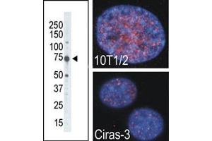 The anti-MSK2 Pab (ABIN390994 and ABIN2837937) is used in Western blot to detect MSK2 in placenta tissue lysate. (MSK2 抗体  (C-Term))