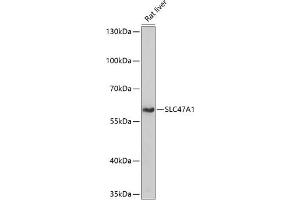 Western blot analysis of extracts of rat liver, using SLC47 antibody (4559) at 1:1000 dilution. (SLC47A1 抗体  (AA 460-550))