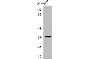 Western Blot analysis of Jurkat cells using Olfactory receptor 5F1 Polyclonal Antibody (OR5F1 抗体  (C-Term))
