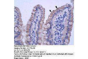 Human Intestine (ZNF358 抗体  (N-Term))