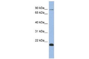 WB Suggested Anti-TCEB3B  Antibody Titration: 0. (TCEB3B 抗体  (Middle Region))