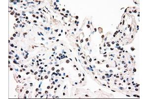 Image no. 1 for anti-B-Raf proto-oncogene, serine/threonine kinase (BRAF) antibody (ABIN1496951) (BRAF 抗体)