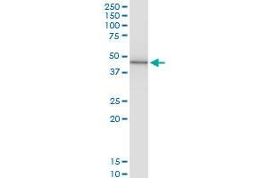 Immunoprecipitation of PRKX transfected lysate using anti-PRKX MaxPab rabbit polyclonal antibody and Protein A Magnetic Bead , and immunoblotted with PRKX purified MaxPab mouse polyclonal antibody (B01P) . (PRKX 抗体  (AA 1-358))