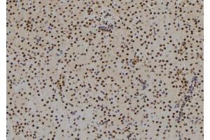 ABIN6279503 at 1/100 staining Mouse kidney tissue by IHC-P. (SIX3 抗体  (C-Term))