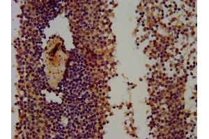 IHC image of ABIN7166179 diluted at 1:300 and staining in paraffin-embedded human spleen tissue performed on a Leica BondTM system. (THEMIS 抗体  (AA 547-641))