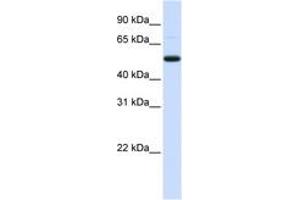 Image no. 1 for anti-DCP2 Decapping Enzyme Homolog (DCP2) (AA 324-373) antibody (ABIN6743046) (DCP2 抗体  (AA 324-373))