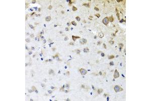 Immunohistochemistry of paraffin-embedded mouse brain using CPA6 antibody (ABIN6291611) at dilution of 1:100 (40x lens). (CPA6 抗体)