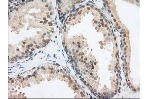 Immunohistochemical staining of paraffin-embedded Human Kidney tissue using anti-PDE4A mouse monoclonal antibody. (PDE4A 抗体)