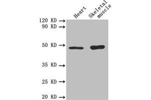 Western blot All lanes: TGFB2 antibody at 3 μg/mL Lane 1: Mouse heart tissue Lane 2: Mouse skeletal muscle tissue Secondary Goat polyclonal to rabbit IgG at 1/10000 dilution Predicted band size: 48, 51 kDa Observed band size: 48 kDa (TGFB2 抗体  (AA 304-413))