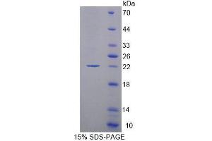 SDS-PAGE analysis of Human MOCS1 Protein. (MOCS1 蛋白)