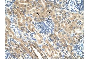 IHH antibody was used for immunohistochemistry at a concentration of 4-8 ug/ml to stain Epithelial cells of renal tubule (arrows) in Human Kidney. (Indian Hedgehog 抗体)