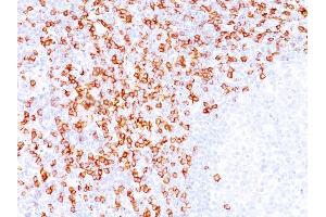 Formalin-fixed, paraffin-embedded human Tonsil stained with CD8A Mouse Monoclonal Antibody (C8/144B). (CD8 alpha 抗体  (C-Term, Cytoplasmic Domain))