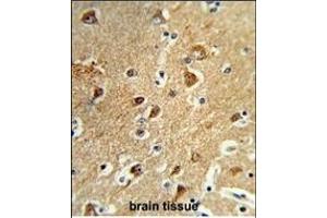 Formalin-fixed and paraffin-embedded human brain tissue reacted with M1H Antibody (Center), which was peroxidase-conjugated to the secondary antibody, followed by DAB staining. (PPM1H 抗体  (AA 235-263))
