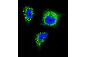 Confocal immunofluorescent analysis of TrkA Antibody f with MDA-M cell followed by Alexa Fluor 488-conjugated goat anti-rabbit lgG (green). (TRKA 抗体)