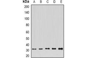 Western blot analysis of FGFBP1 expression in A549 (A), HepG2 (B), NIH3T3 (C), mouse kidney (D), rat brain (E) whole cell lysates. (FGFBP1 抗体)